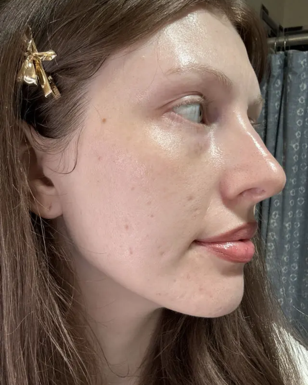 Brightening Face Creme before and after