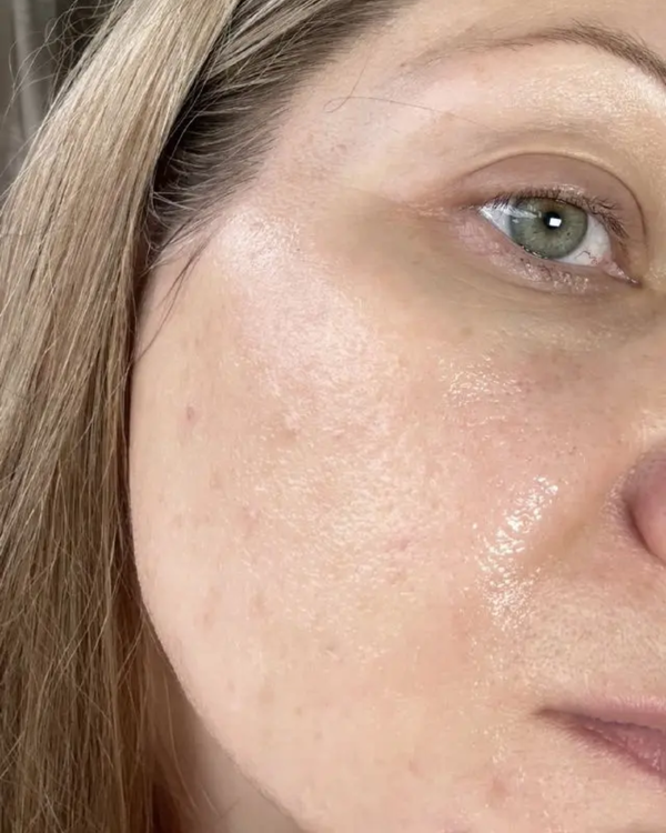 Brightening Face Creme before and after