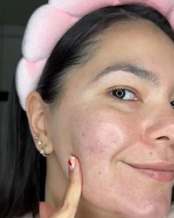 Brightening Face Creme before and after