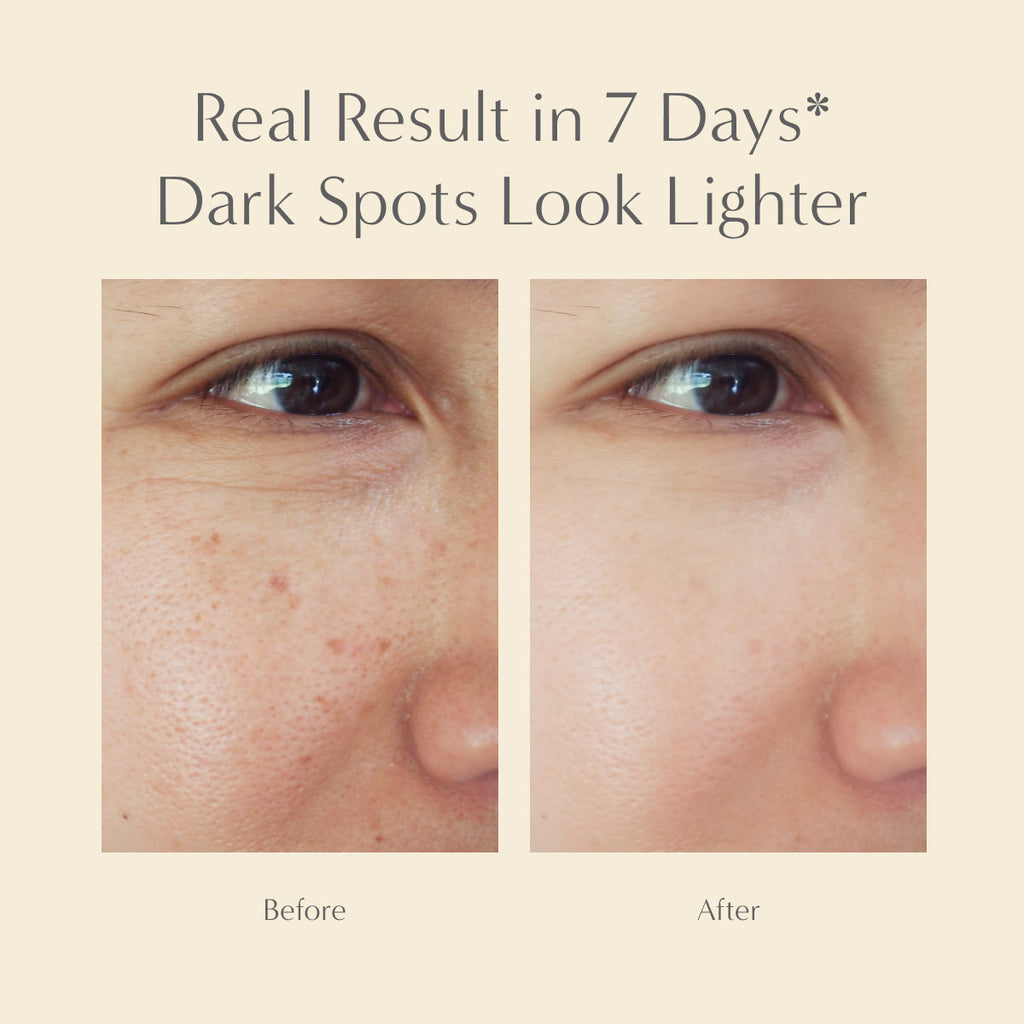 Gold Radiance Serum